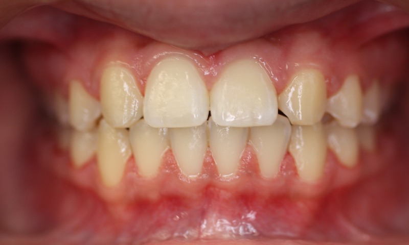 After Image