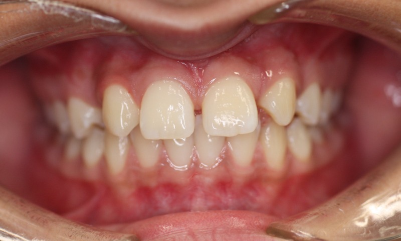 Before Image