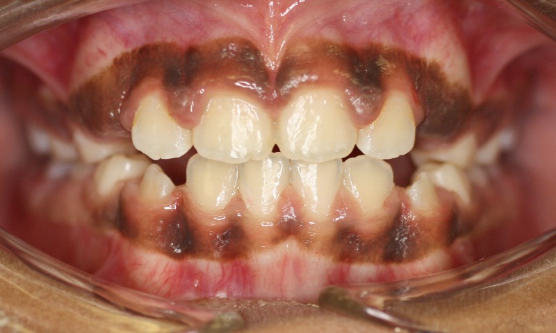 After Image