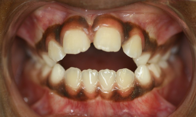Before Image