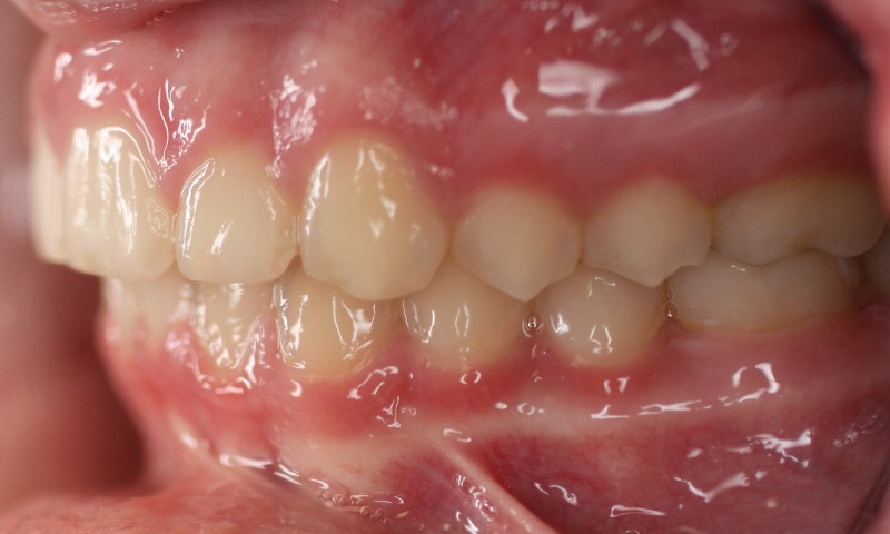 After Image