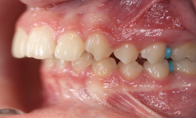Before Image