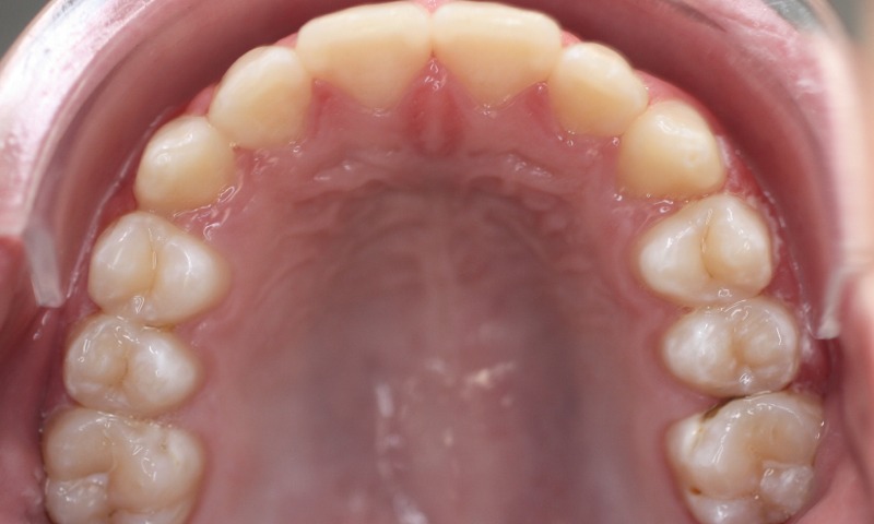 After Image