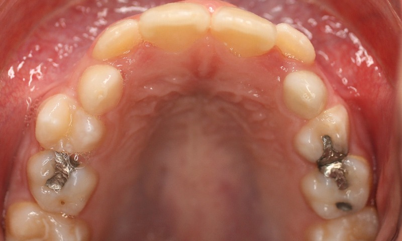 Before Image