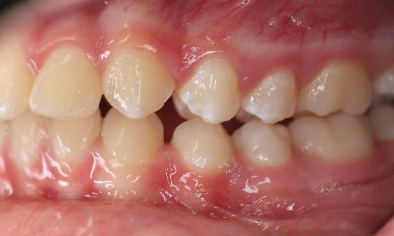Before Image