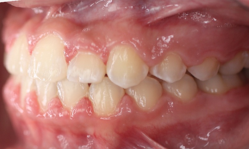 After Image