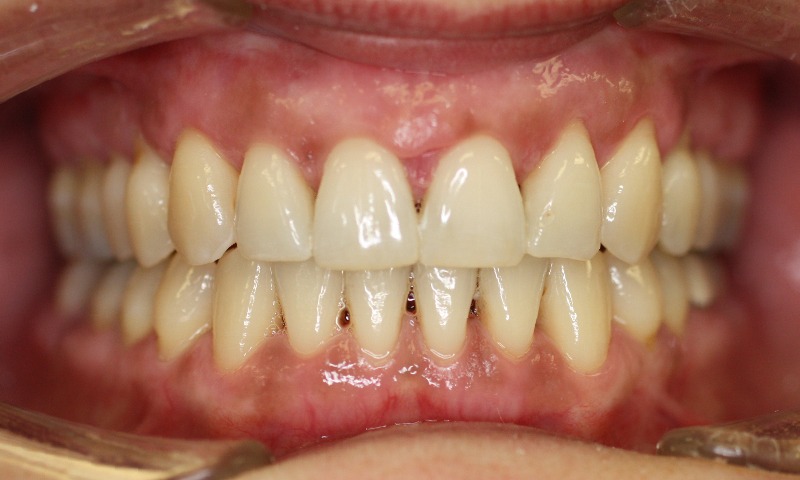 After Image