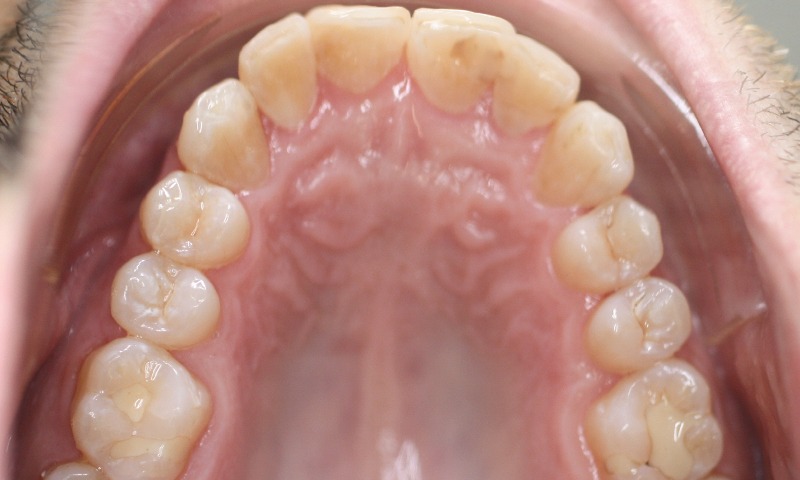 After Image