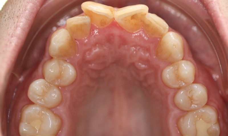Before Image