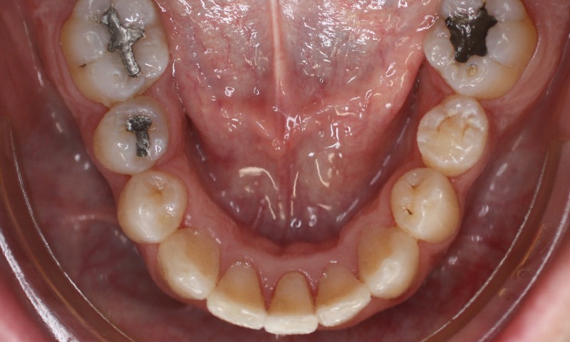 After Image