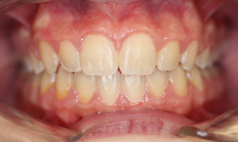 After Image