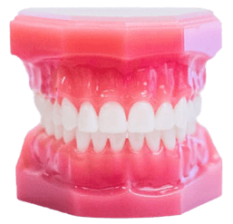 metal braces on model