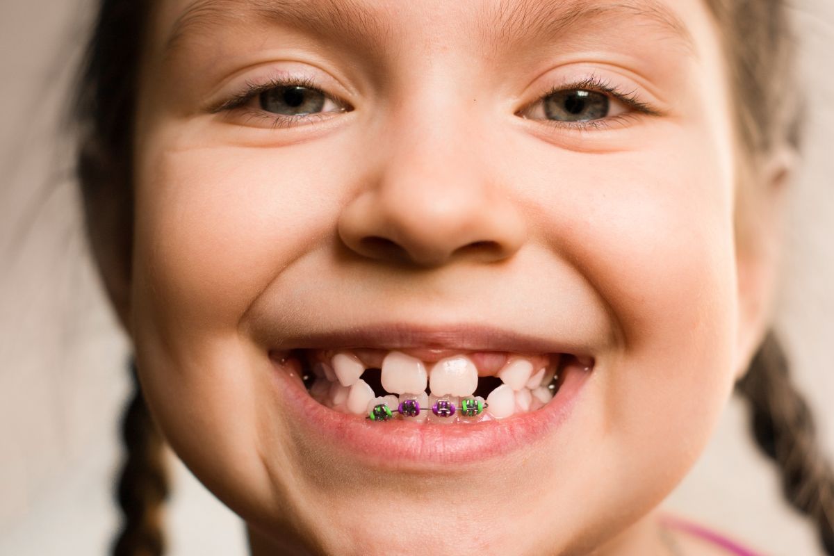 Benefits of Choosing an Orthodontic Expert for Your Smile