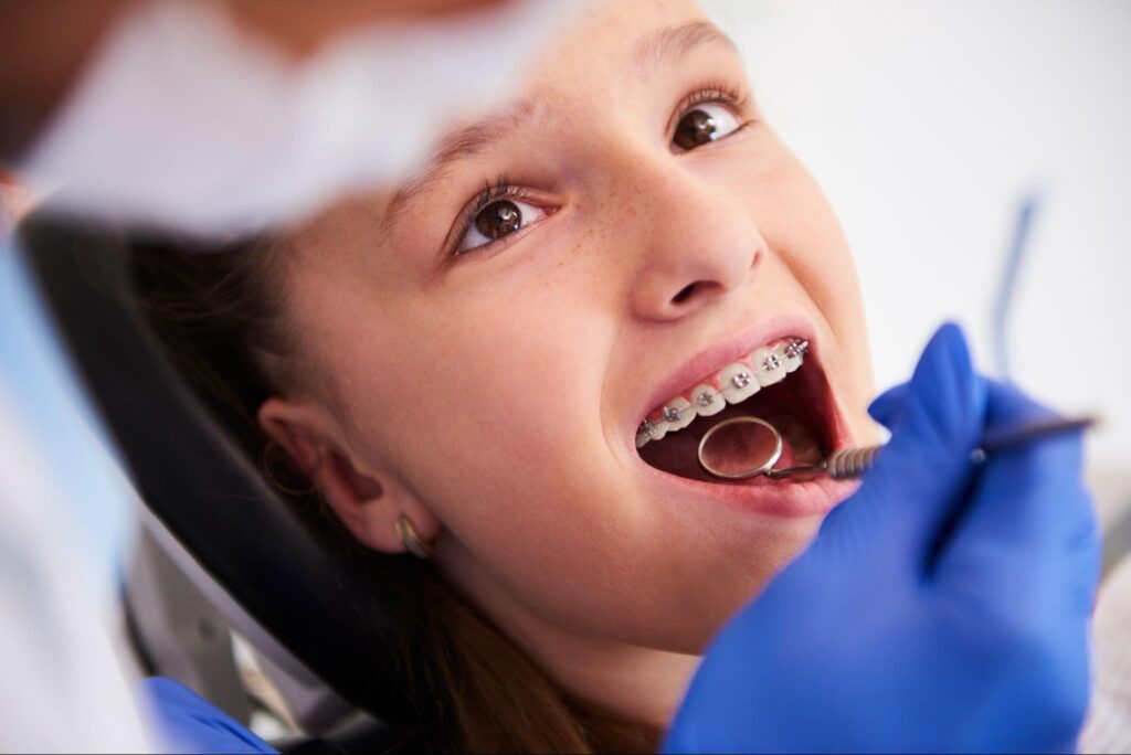 Does Early Orthodontic Treatment Improve Dental Health?