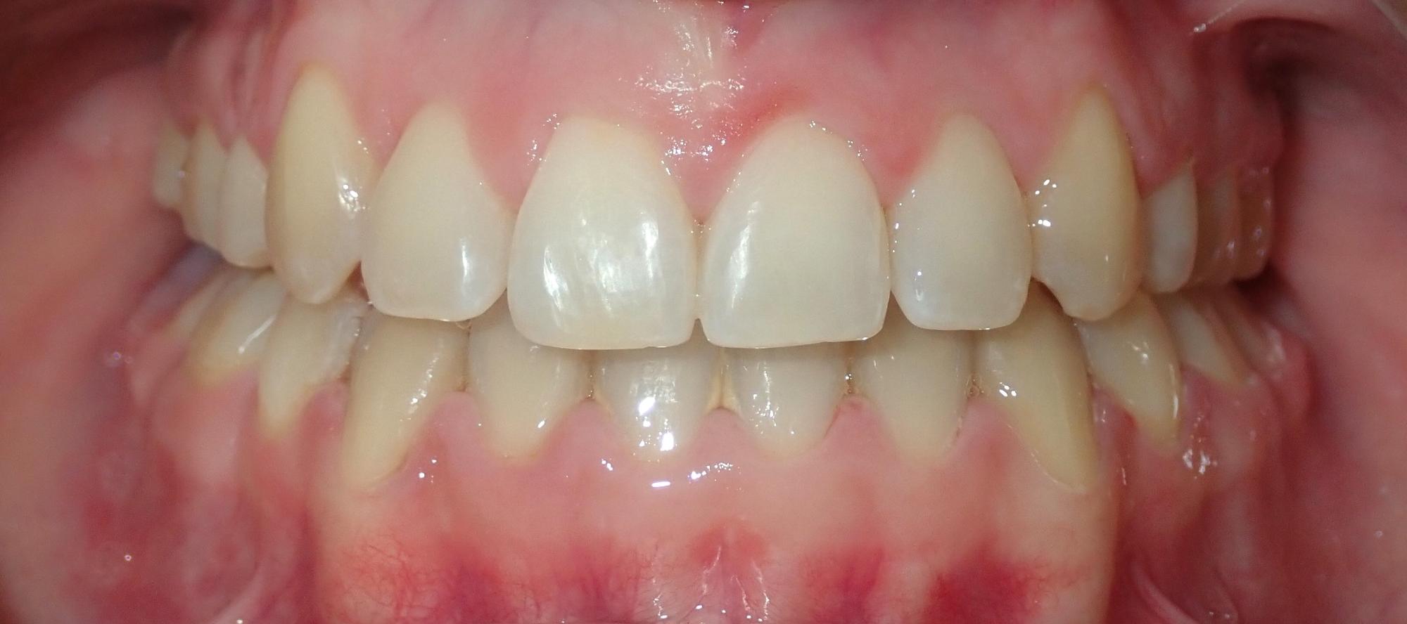 northport orthodontics