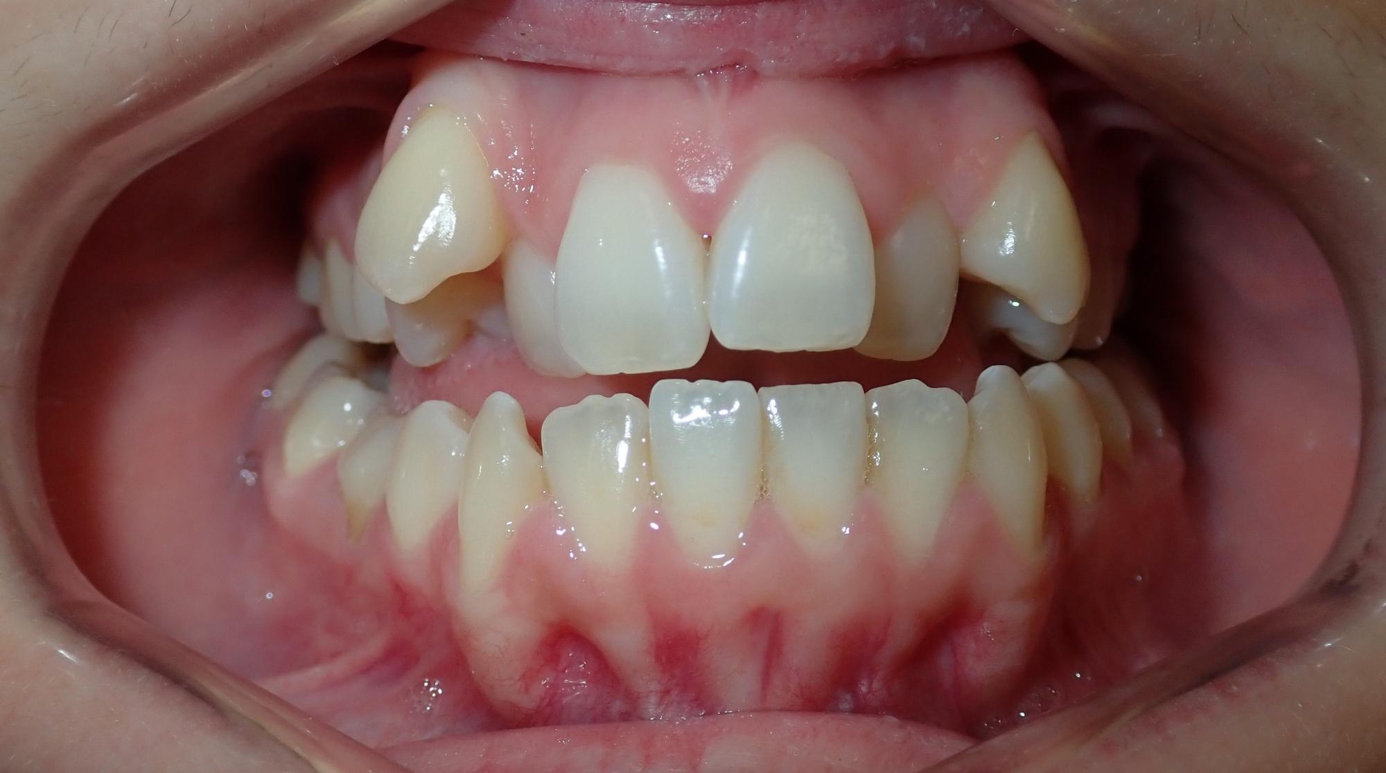 northport orthodontics