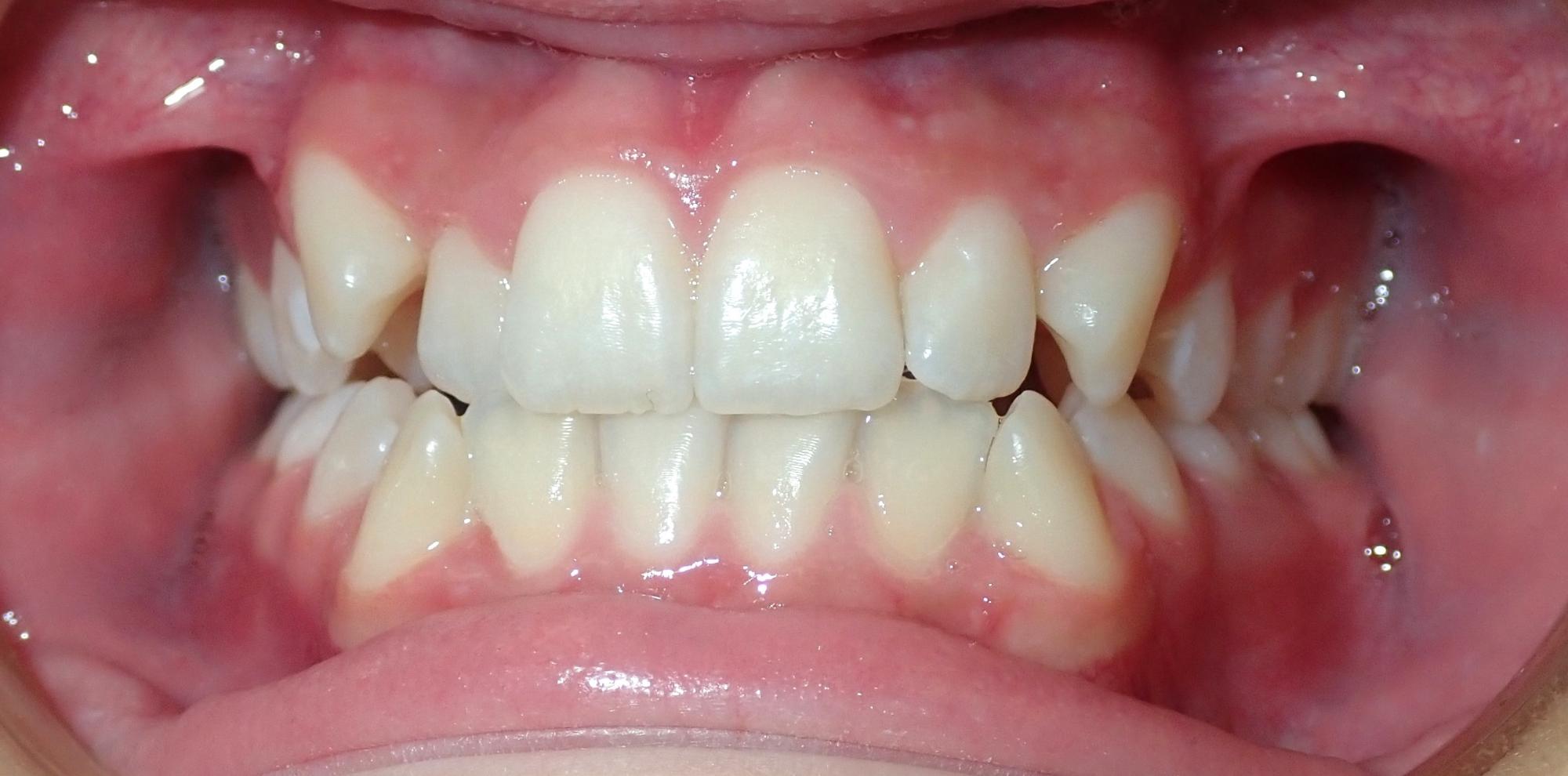 northport orthodontics