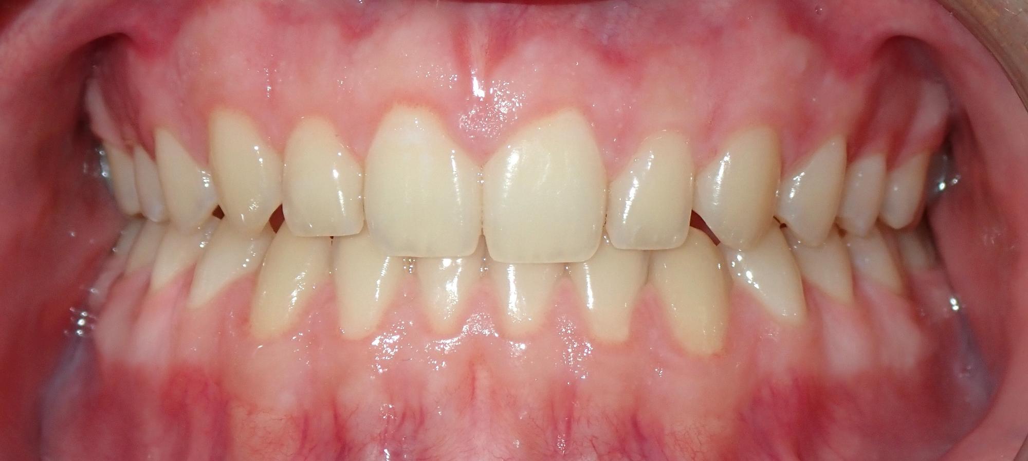 northport orthodontics