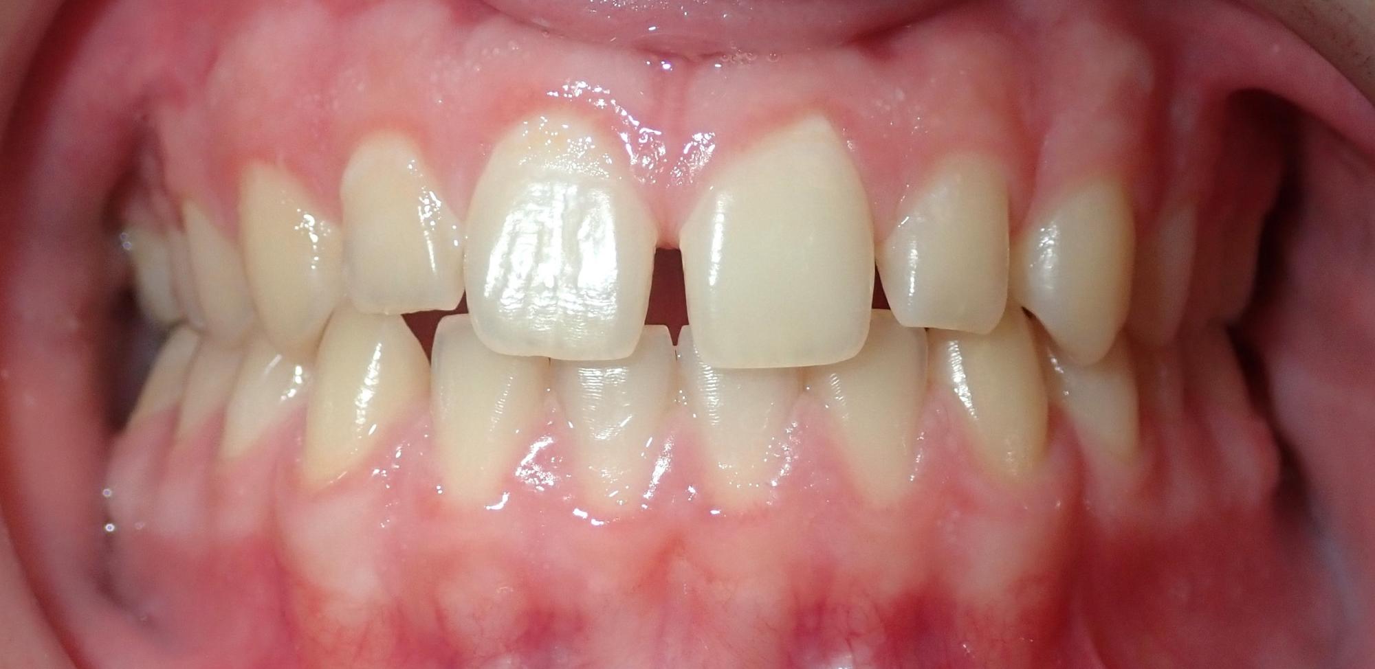 northport orthodontics